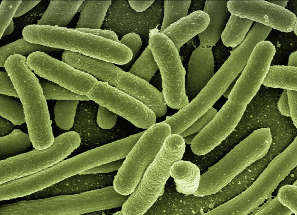 shigella bacteria cdc